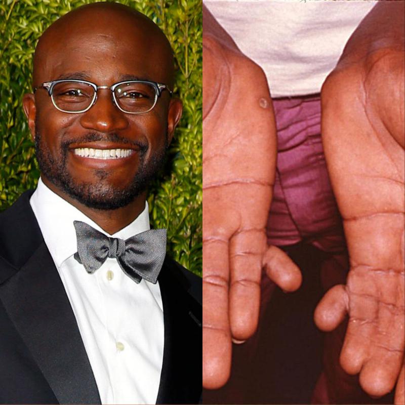 Taye Diggs’s Two ExtraFingers 11