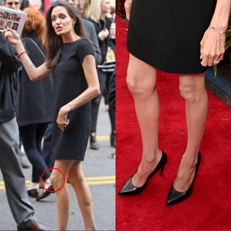 Angelina Jolie’s Knobby Knees 16