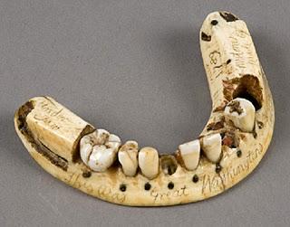 Before dentures were invented, teeth were pulled from the mouths of dead soldiers for use as prosthetics.