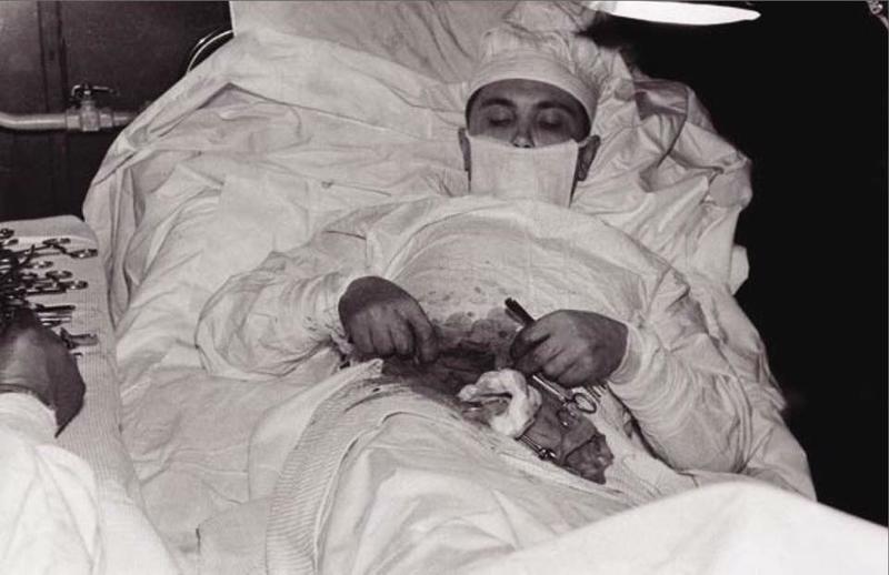 Dr. Leonid Rogozov performing surgery on himself in 1967.