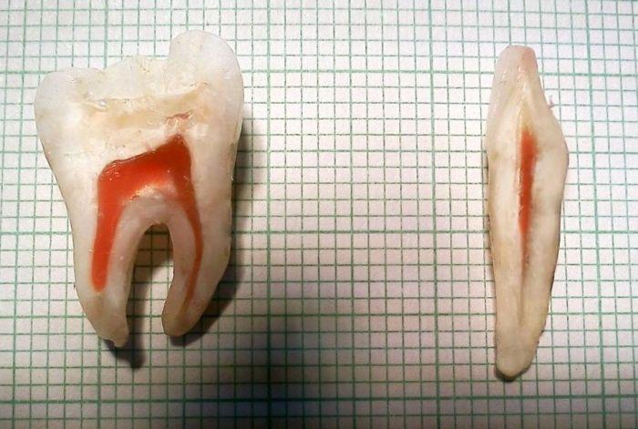 The Inside Of Some Teeth.